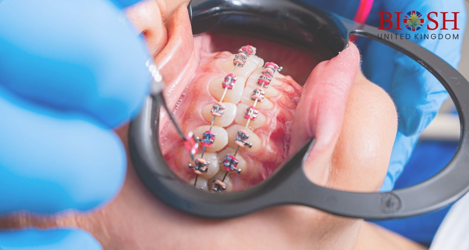 Orthodontics